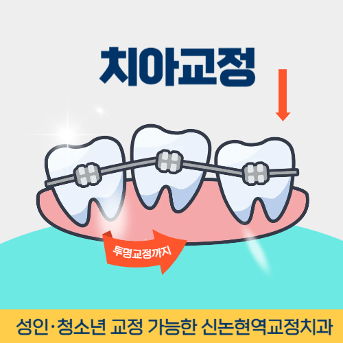 오산치과 오산시 치과 치아교정