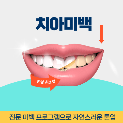 오산치과 오산시 치과 치아미백